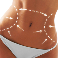 tummy tuck