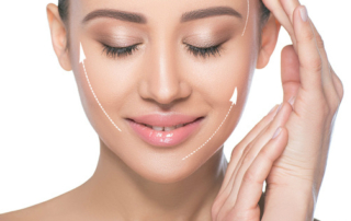 facelift surgery