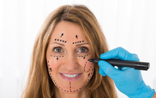 face lift