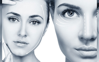 face lift in tunisia