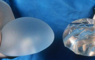 breast implants tunisia
