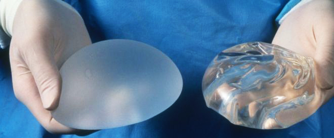 breast implants tunisia