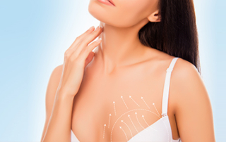 breast lifting tunisia