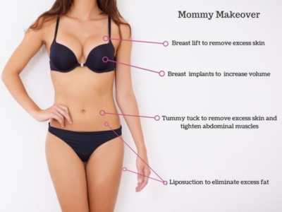mommy makeover tunis