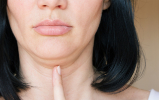 treatment double chin tunisia