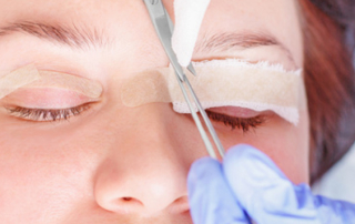 Eyelid lift tunisia
