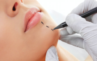 facial surgery
