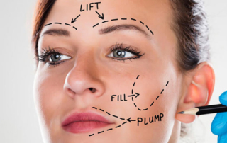 facelift surgery tunis
