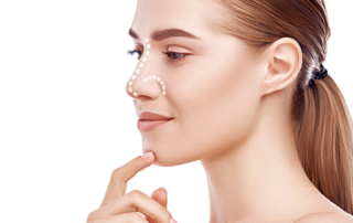 rhinoplasty in tunisia