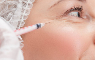 Wrinkles dark circles hyaluronic acid