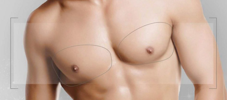 surgery men boobs tunisia