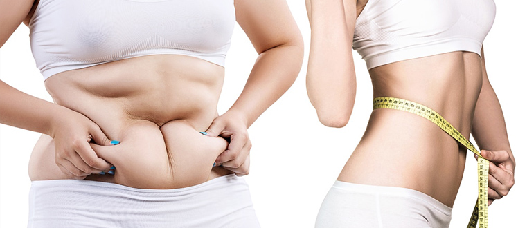 all about liposuction