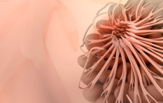 breast hyperplasia