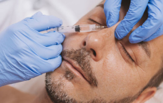 Medical rhinoplasty tunisia