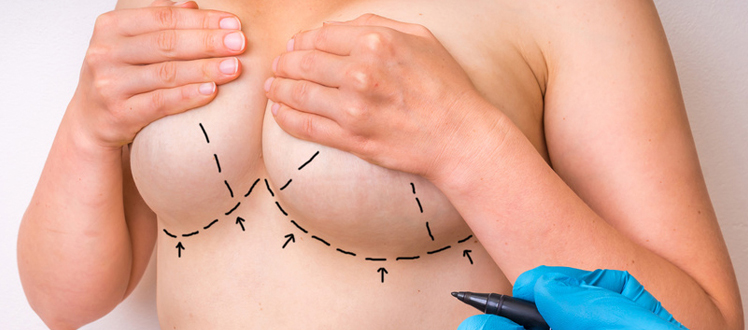 breast lift surgery