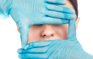 rhinoplasty-faq
