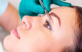 blepharoplasty eyelid lift tunisia