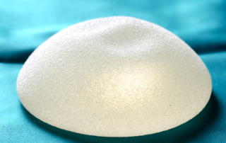 breast implants
