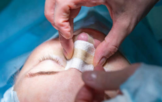 surgery nose imperfections