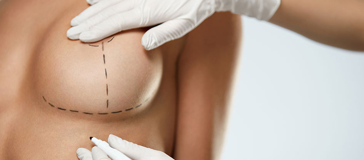 Breast lift or augmentation