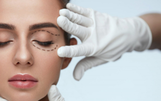 blepharoplasty eyelid lift tunisia dr balti