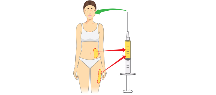 facial fat grafting in tunisia