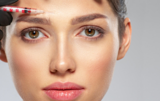How Botox alleviated wrinkles
