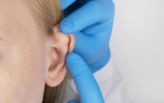 reparir correct earlobes tunisia