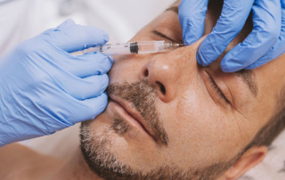 Nasal hump : what it is and how to remove it