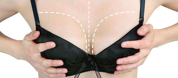 alternative-to-breast-implants