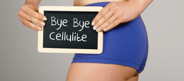 treat-cellulite