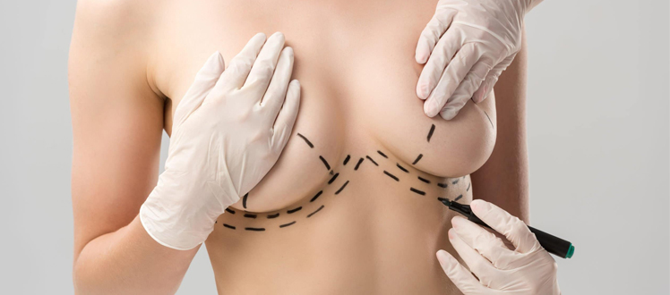 Breast-lift