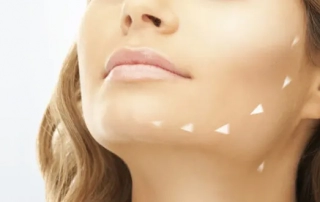 Treating chin imperfections tunisia