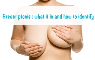 Breast ptosis-what it is and how to identify it