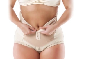 Minimising swelling after liposuction