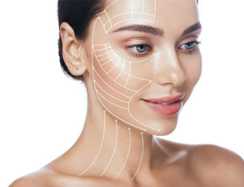 How to manage the face lift’s postoperative course